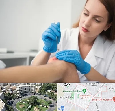 متخصص زخم در جهانشهر کرج 