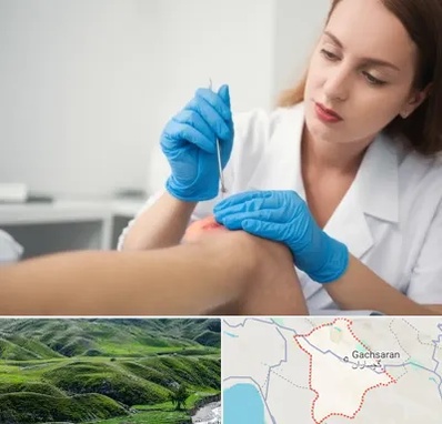 متخصص زخم در گچساران
