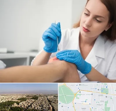 متخصص زخم در نازی آباد 