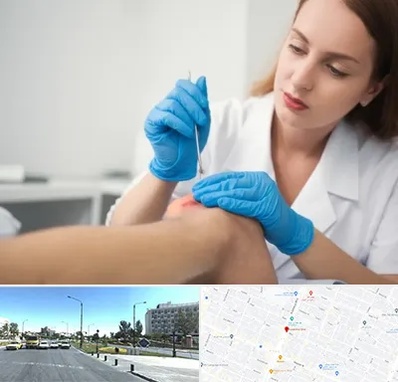 متخصص زخم در بلوار کلاهدوز مشهد 