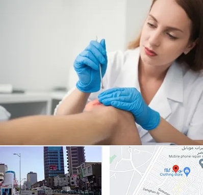 متخصص زخم در چهارراه طالقانی کرج 