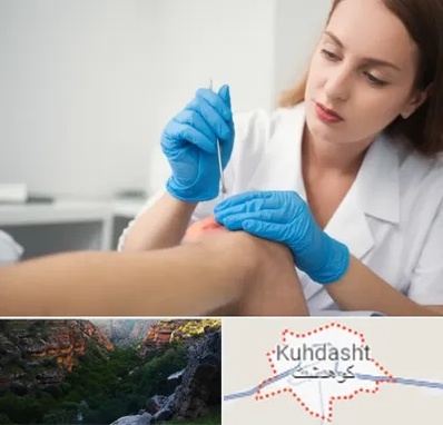 متخصص زخم در کوهدشت