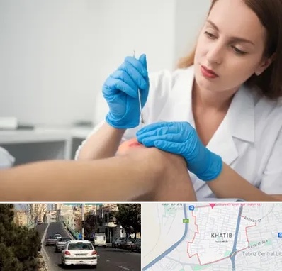 متخصص زخم در خطیب تبریز 