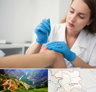 متخصص زخم در کردستان