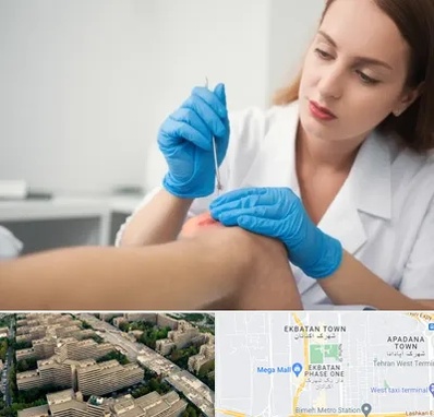 متخصص زخم در اکباتان 