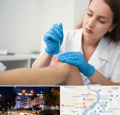 متخصص زخم در کیانپارس اهواز 