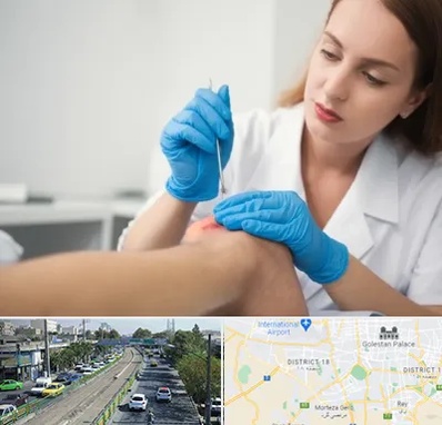 متخصص زخم در جنوب تهران 