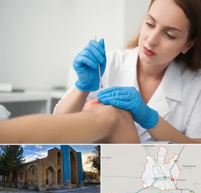 متخصص زخم در اهر