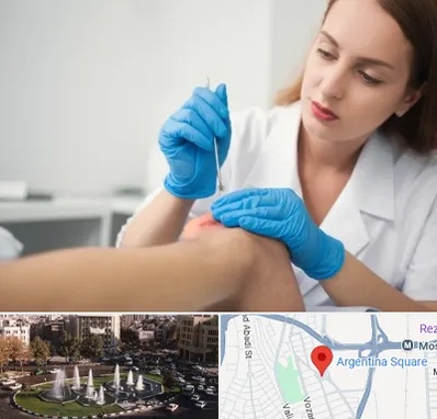 متخصص زخم در آرژانتین