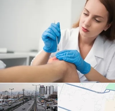 متخصص زخم در بلوار ارتش 