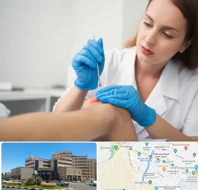 متخصص زخم در صیاد شیرازی مشهد 