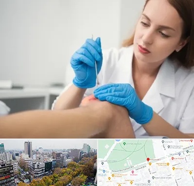 متخصص زخم در بلوار کشاورز