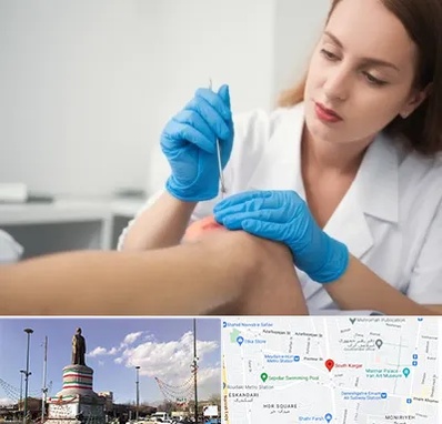 متخصص زخم در کارگر جنوبی