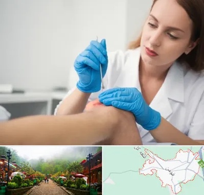 متخصص زخم در فومن