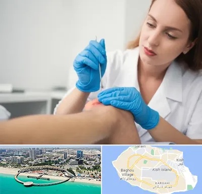 متخصص زخم در کیش