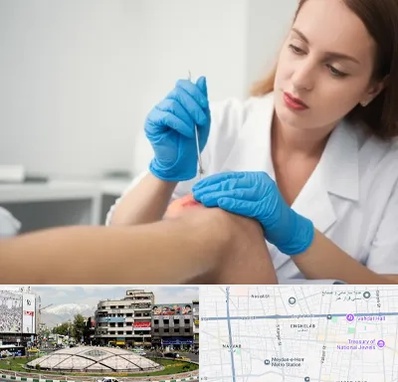 متخصص زخم در مرکز تهران 