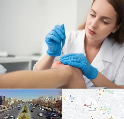 متخصص زخم در بلوار معلم مشهد 