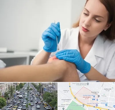 متخصص زخم در گلشهر کرج 