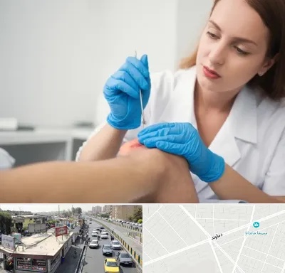 متخصص زخم در خیابان دماوند