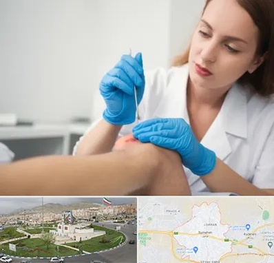 متخصص زخم در بومهن