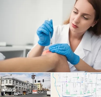 متخصص زخم در 17شهریور