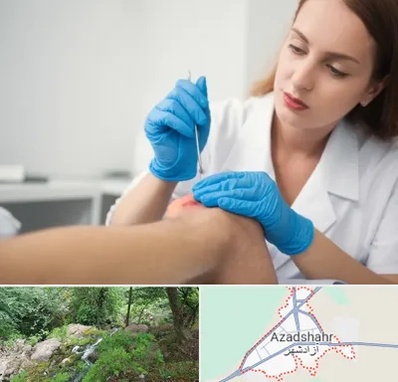 متخصص زخم در آزادشهر