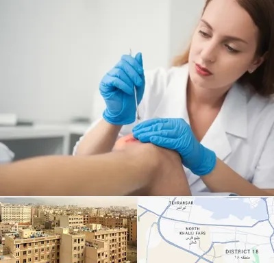 متخصص زخم در جنوب غرب تهران