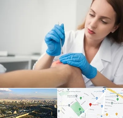 متخصص زخم در هنگام 