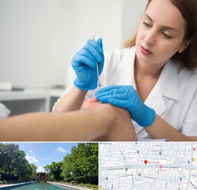 متخصص زخم در هشت بهشت اصفهان 