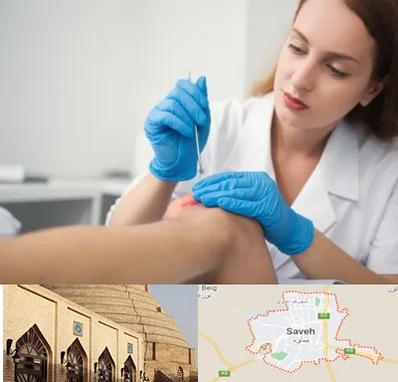 متخصص زخم در ساوه