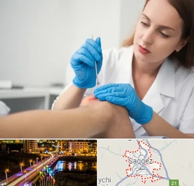 متخصص زخم در سقز