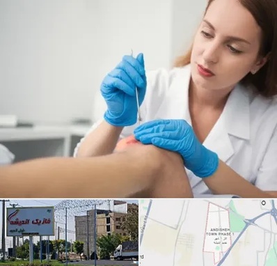 متخصص زخم در فاز یک اندیشه