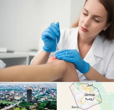 متخصص زخم در ارومیه