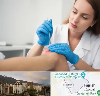 متخصص زخم در زعفرانیه 