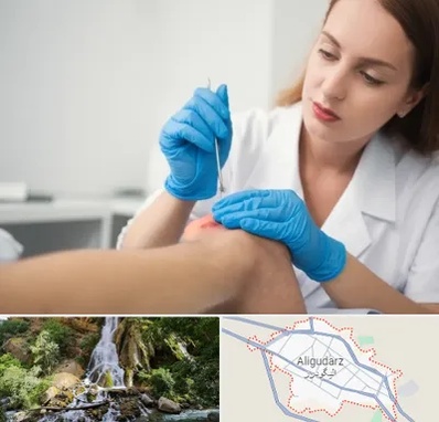 متخصص زخم در الیگودرز