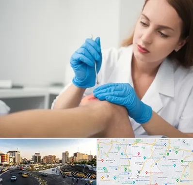 متخصص زخم در منطقه 7 تهران 