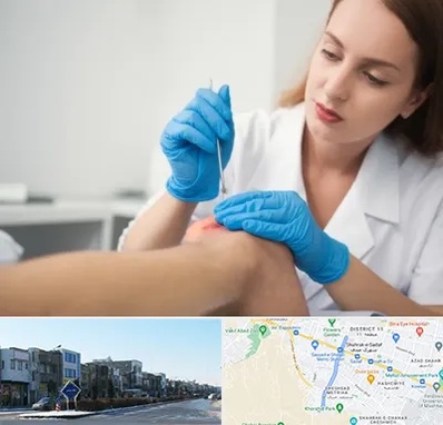 متخصص زخم در شریعتی مشهد 