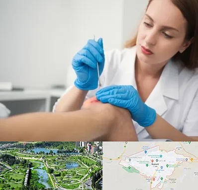 متخصص زخم در بجنورد