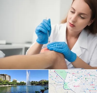 متخصص زخم در کوهسنگی مشهد 