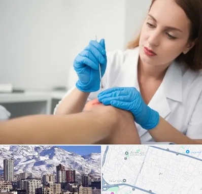 متخصص زخم در ازگل 