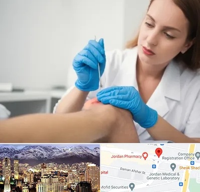 متخصص زخم در جردن 