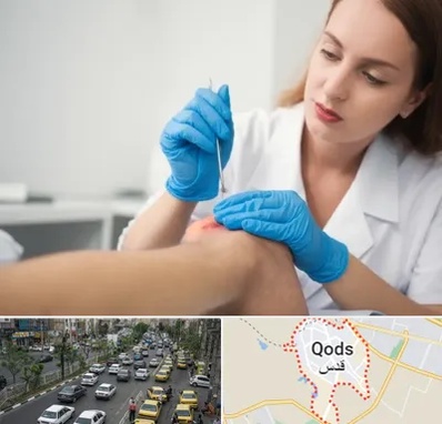 متخصص زخم در شهر قدس