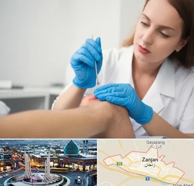 متخصص زخم در زنجان