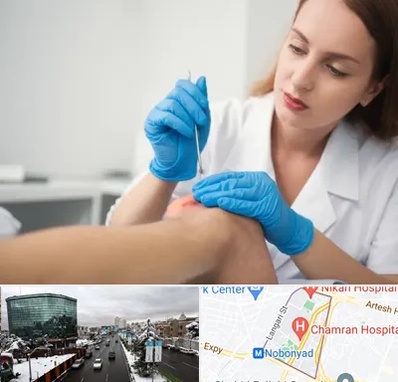 متخصص زخم در اقدسیه 