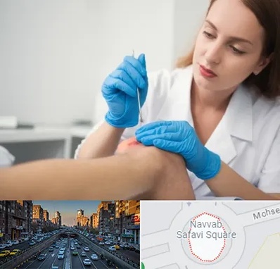 متخصص زخم در نواب 