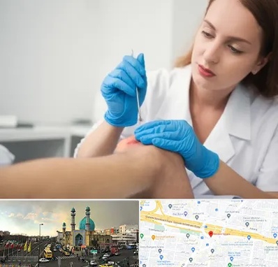 متخصص زخم در رسالت 