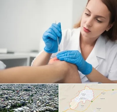 متخصص زخم در شاهرود