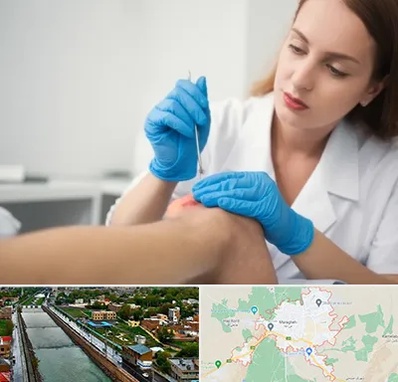 متخصص زخم در مراغه