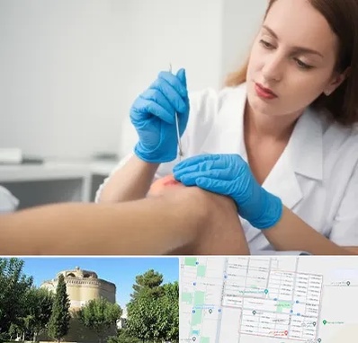 متخصص زخم در مرداویج اصفهان 