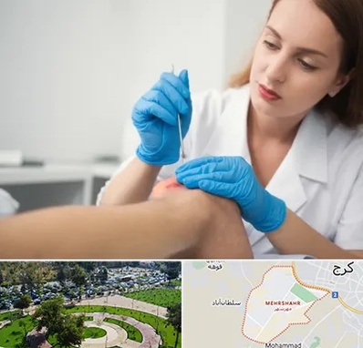 متخصص زخم در مهرشهر کرج 